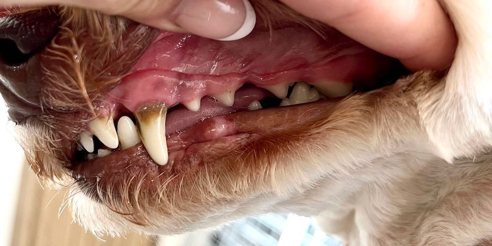 Before-Ultrasonic Teeth-Cleaning-Left